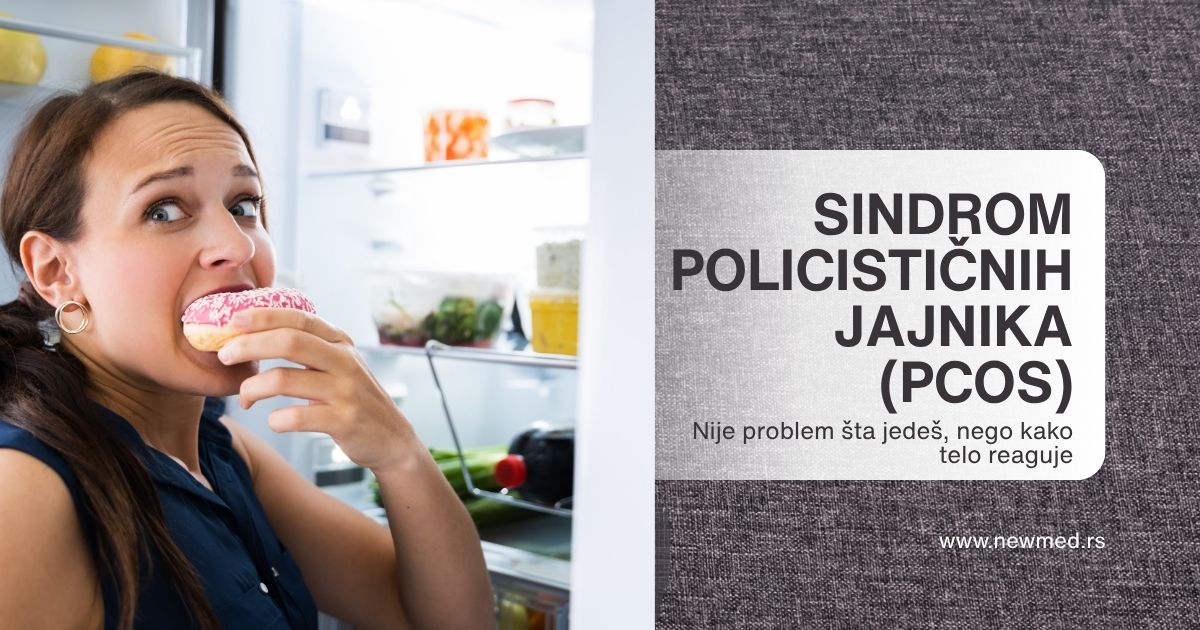 PCOS- nije problem sta jedes