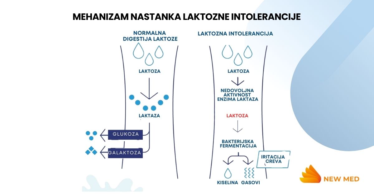 laktoza i laktozna intolerancija